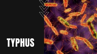 What Is Typhus Symptoms Spread and Suppression [upl. by Coward500]