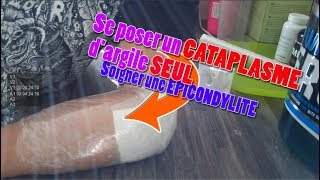 CATAPLASME dARGILE SEUL  Soigner une EPICONDYLITE [upl. by Yesima885]