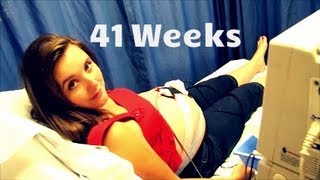 41 Weeks Pregnant  Ultrasound  Membrane Sweep [upl. by Wenoa]