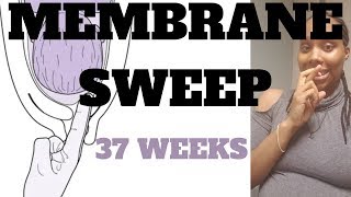 Membrane Sweep 37 Weeks [upl. by Zirtaeb]