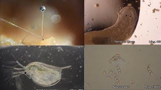 The Amazing Microscopic World [upl. by Noroj]